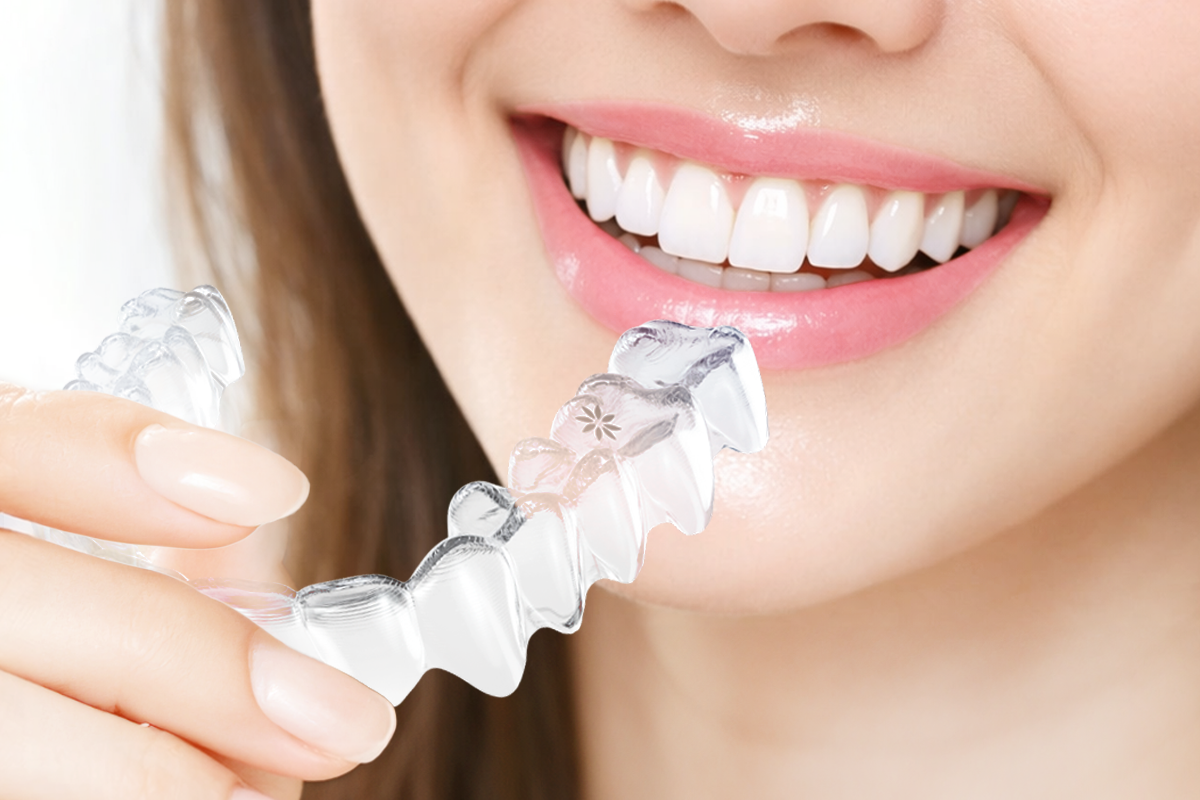 1:1 맞춤 치아교정 이미지