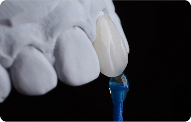 스위스에서 건너온 아름다운 세라믹 제작 기술력, 오랄디자인