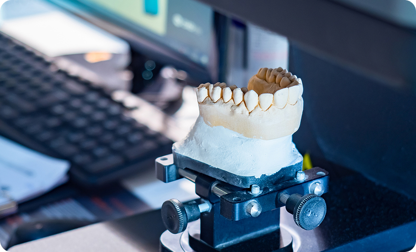 신체의 일부가 되는 치과 기공물, 원탑은 자체 디지털 기공소에서 제작합니다.