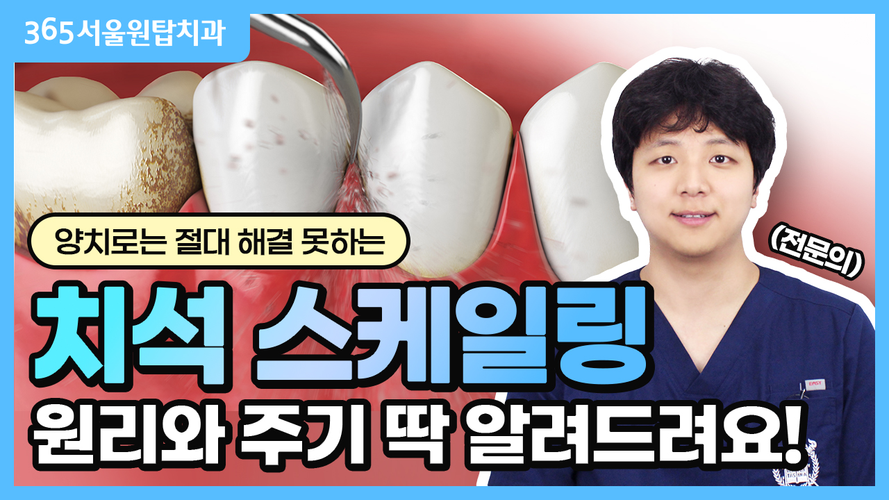 스케일링 주기와 원리 딱 정해드립니다! | 스케일링 더 자주 받아야 하는 체질?!