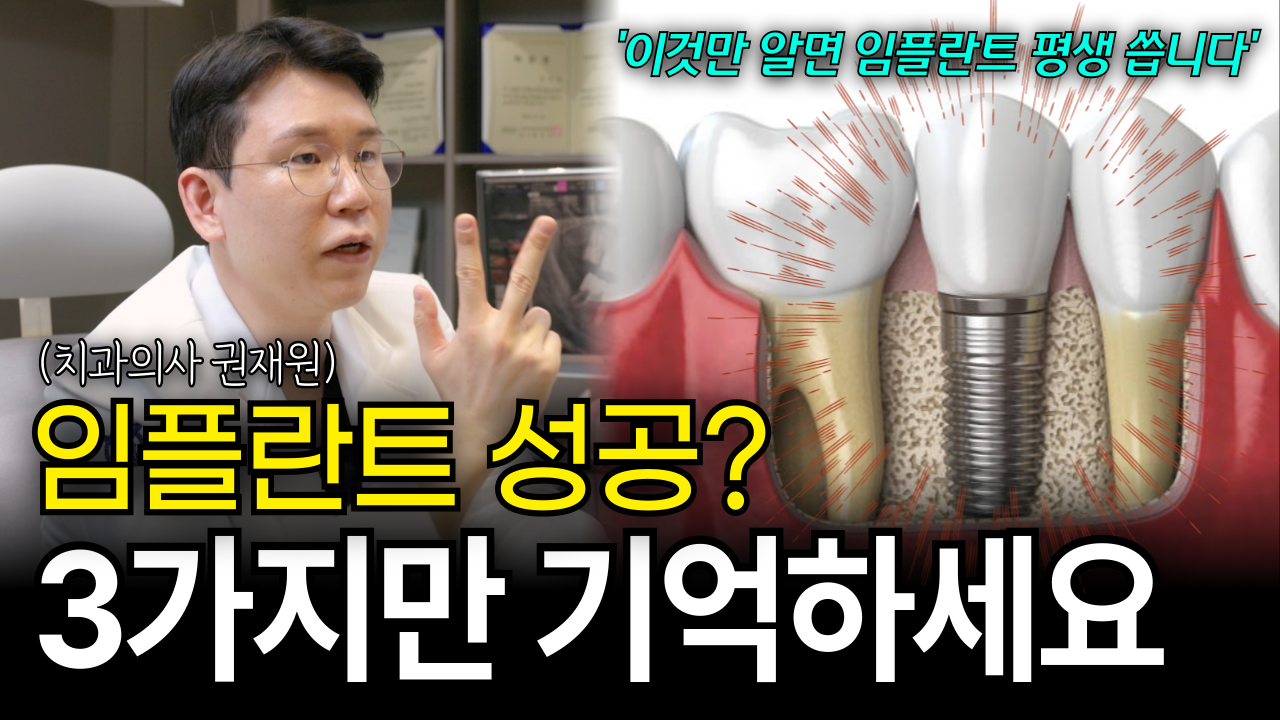 임플란트 수술 성공하려면, 상담할 때 3가지를 꼭 확인하세요