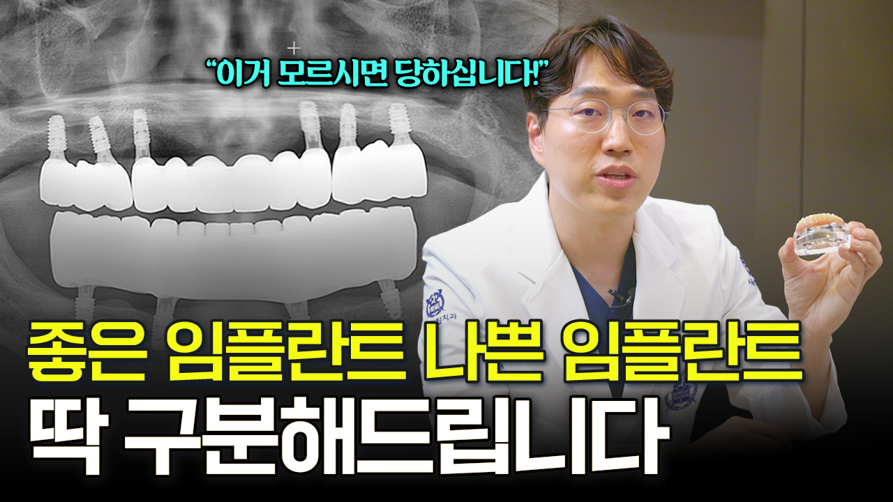  전체 임플란트 몇개 심는게 좋아요? 평생 쓰려면 '이것'만 기억하세요