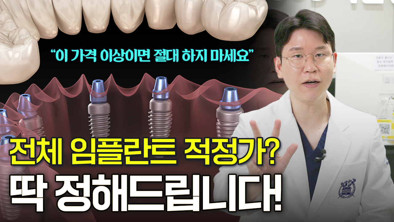 전체임플란트 비용, 병원마다 임플란트 비용 다른 이유는 '이거' 때문입니다