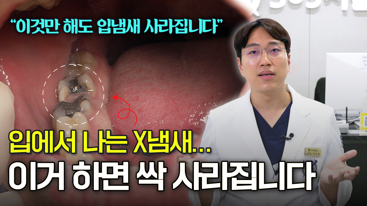 입냄새 진짜 쉽게 사라지는 방법 3가지, 집에서 거울보고 치아 확인해보세요