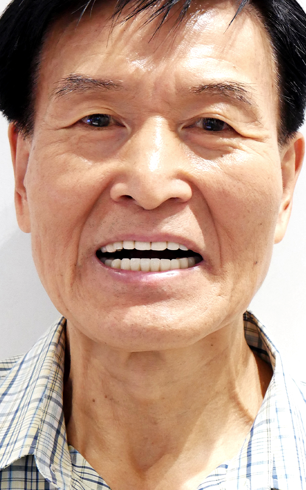 전체 틀니가 잘 맞지 않아 불편하셨던